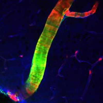 Scientists Discover Previously Unknown Cleansing System in Brain