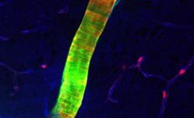 Scientists Discover Previously Unknown Cleansing System in Brain