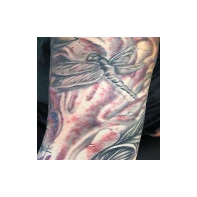 In Rochester, a Tale of Tainted Tattoos