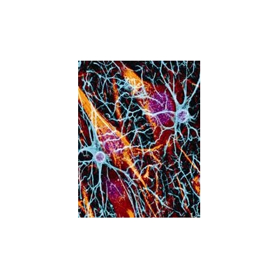 Researchers at the Doorstep of Stem Cell Therapies for MS, Other Myelin Disorders