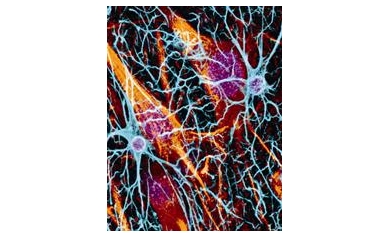 Researchers at the Doorstep of Stem Cell Therapies for MS, Other Myelin Disorders
