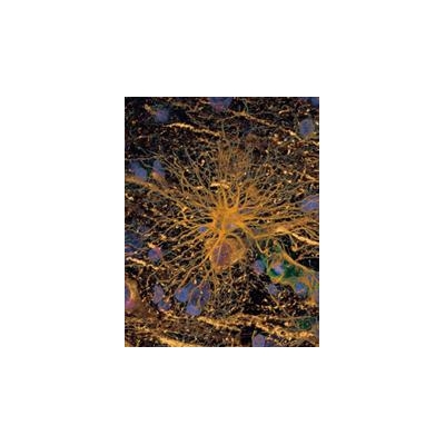 Scientists Create “Endless Supply” of Myelin-Forming Cells