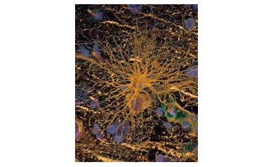 Scientists Create “Endless Supply” of Myelin-Forming Cells