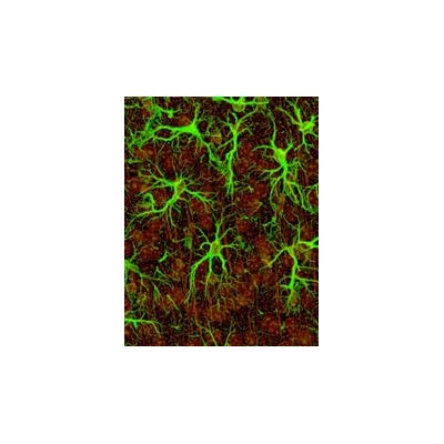 Study: Model for Brain Signaling Flawed