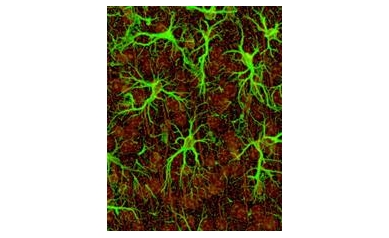 Study: Model for Brain Signaling Flawed