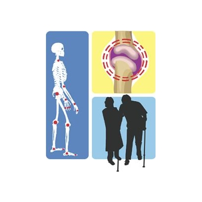 URMC Orthopaedists Connect Science, Common Health Burdens
