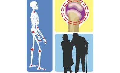 URMC Orthopaedists Connect Science, Common Health Burdens