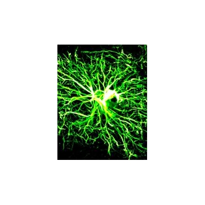 Cells Forged from Human Skin Show Promise in Treating MS, Myelin Disorders