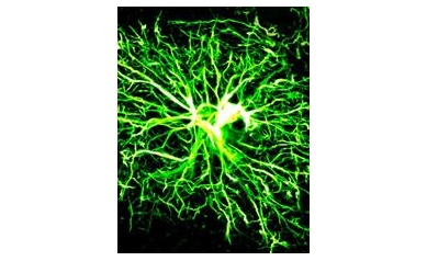 Cells Forged from Human Skin Show Promise in Treating MS, Myelin Disorders