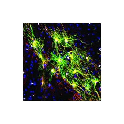 Support Cells Found in Human Brain Make Mice Smarter