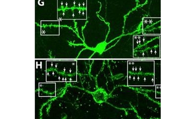 Scientists Coax Brain to Regenerate Cells Lost in Huntington’s Disease
