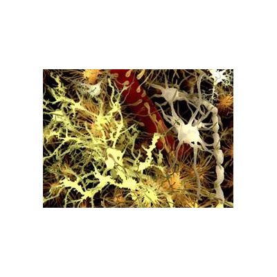 Finding Points to Possible New Parkinson’s Therapy