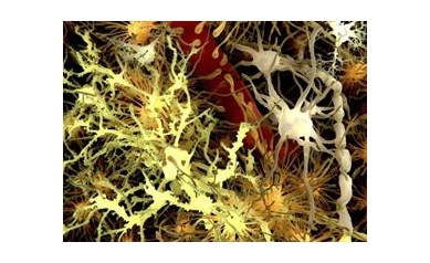 Finding Points to Possible New Parkinson’s Therapy