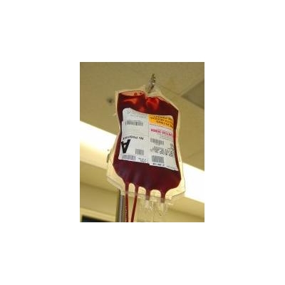 Like Hand-Washing, Blood Transfusions Linked to Infections