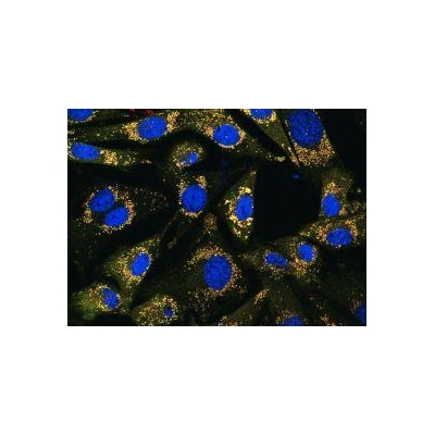 Gene Discovery Links Cancer Cell ‘Recycling’ System to Potential New Therapy