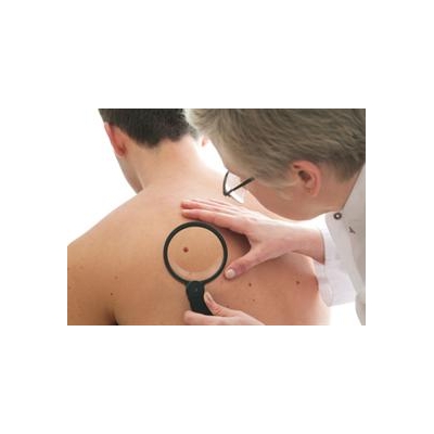 Get Free Skin Cancer Screening on May 31