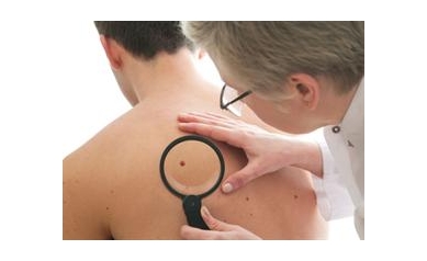 Get Free Skin Cancer Screening on May 31