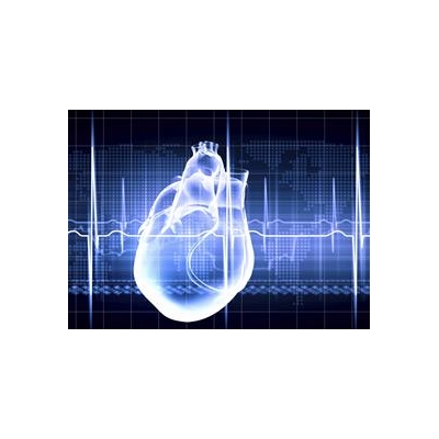 $4M NIH Grant Supports UR Research to Prevent Sudden Cardiac Death