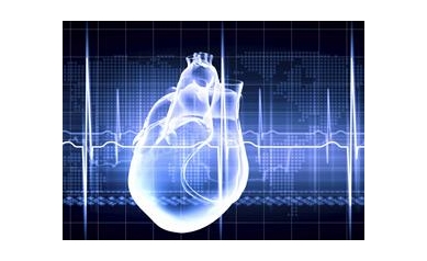 $4M NIH Grant Supports UR Research to Prevent Sudden Cardiac Death