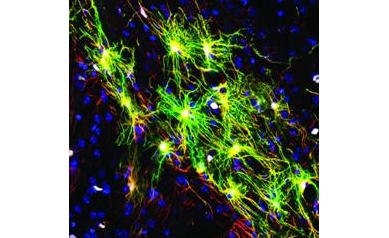 Research Seeks to Break New Ground in Understanding of Schizophrenia