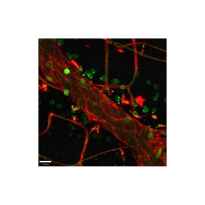 Researchers Receive $4 Million to Study  Common and Costly Cause of Death: Sepsis