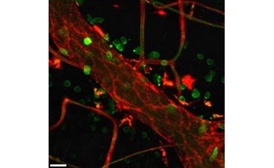 Researchers Receive $4 Million to Study  Common and Costly Cause of Death: Sepsis