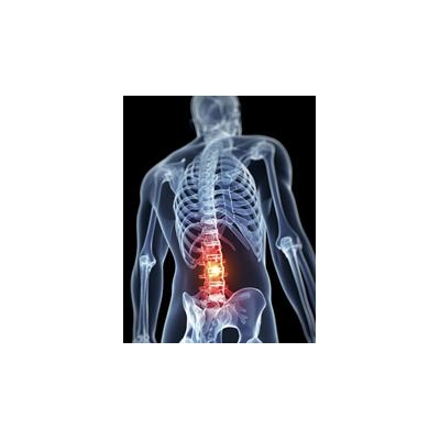 Commonly Prescribed Drug for Lower Back Pain Not Effective