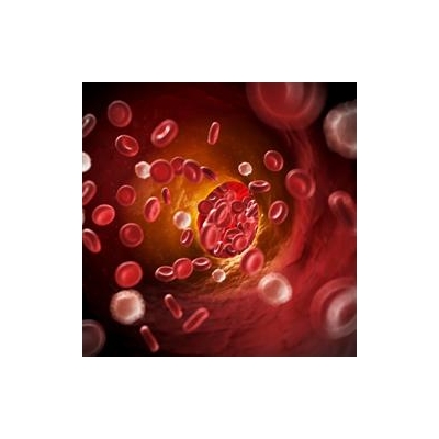 New Study Probes Link Between HIV Drugs and Vascular Disease