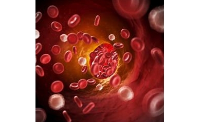 New Study Probes Link Between HIV Drugs and Vascular Disease
