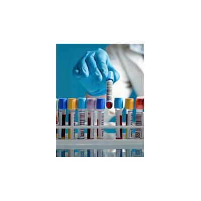 Blood Test for Brain Injury May Not Be Feasible