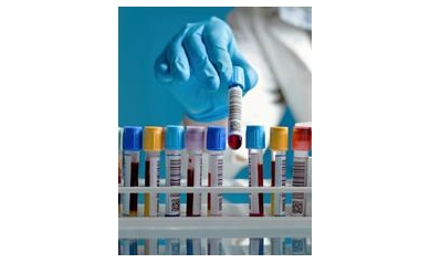 Blood Test for Brain Injury May Not Be Feasible