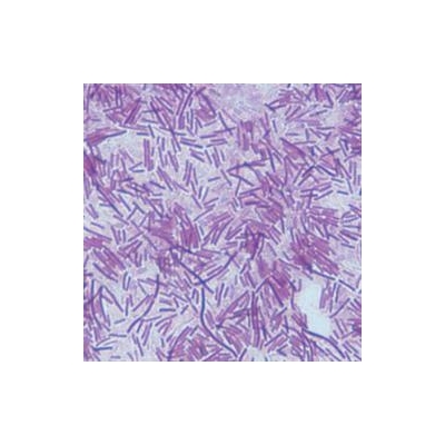 New Study Details Burden of C. Diff in U.S.