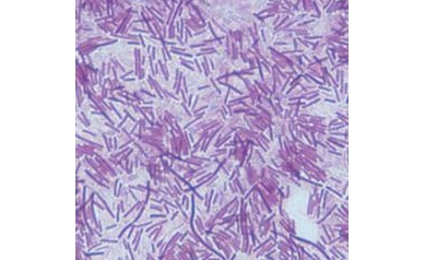 New Study Details Burden of C. Diff in U.S.