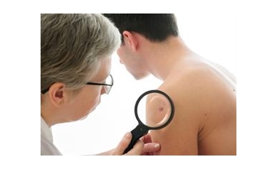 Free Skin Cancer Screening Offered May 30