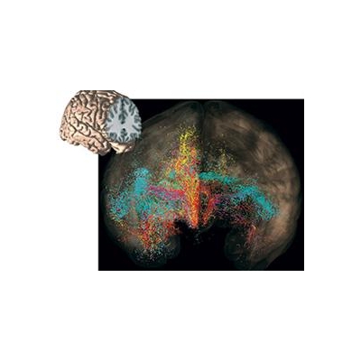 $10 Million Grant Funds Center to Study OCD at UR School of Medicine and Dentistry