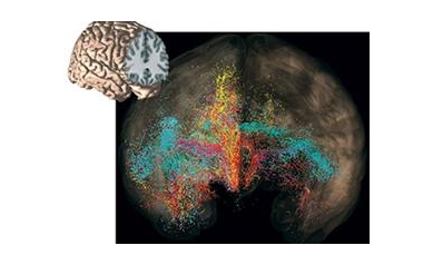 $10 Million Grant Funds Center to Study OCD at UR School of Medicine and Dentistry