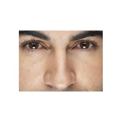 UR Medicine Experts Discuss Sjogren’s Syndrome Therapies June 11
