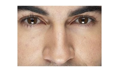 UR Medicine Experts Discuss Sjogren’s Syndrome Therapies June 11