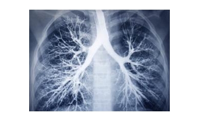 Combination Treatment for Fatal Lung Disease Shows Promise