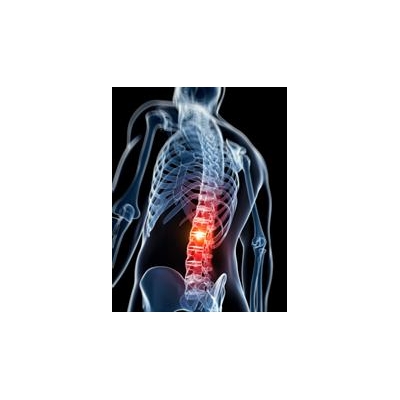 Patients Prefer Relief from Lower Back Pain Over Improved Mobility