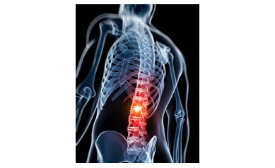 Patients Prefer Relief from Lower Back Pain Over Improved Mobility