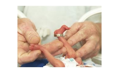 Study: Extreme Preemies Have a Better Chance of Survival Today