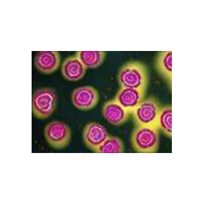 $3 Million Funds Research to Develop New HIV Vaccine Strategies