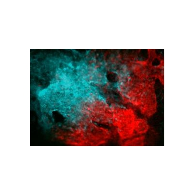 Scientists Discover Stem Cells Capable of Repairing Skull, Face Bones
