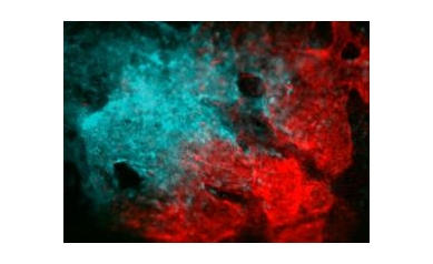 Scientists Discover Stem Cells Capable of Repairing Skull, Face Bones