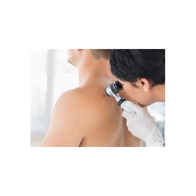 Dermatologists to Offer Free Skin Cancer Screening May 7