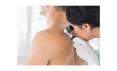 Dermatologists to Offer Free Skin Cancer Screening May 7