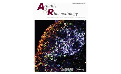 New Bone Chewing Role for B Cells in Rheumatoid Arthritis