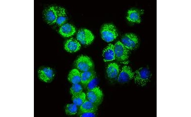 Drug Helps Reduce Involuntary Movements for People with Huntington Disease