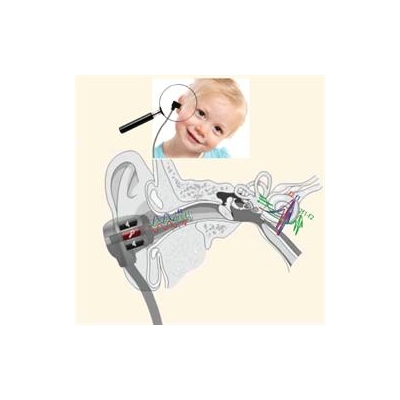 Hearing Test May Identify Autism Risk